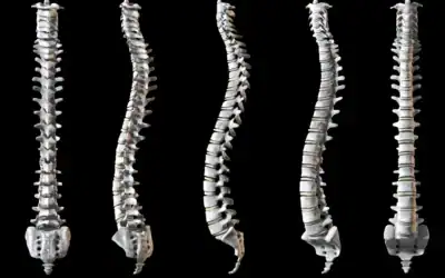 5 Signs Your Spine is Crying for Help