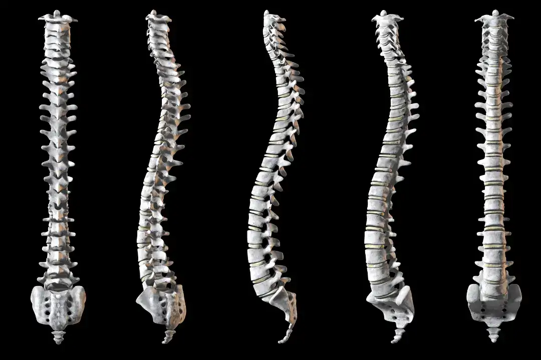 5 spines in different angles